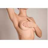 clínica que faz mamoplastia pós bariátrica Santa Cecília