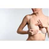 mamoplastia e mastopexia Socorro